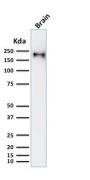 Neurofilament (NF-H) (Neuronal Marker) (rNF421), CF594 conjugate, 0.1mg/mL