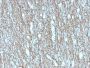 Neurofilament (NF-H) (Neuronal Marker) (rNF421), CF594 conjugate, 0.1mg/mL