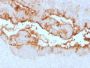 MUC16 / CA125 (Ovarian Carcinoma Marker) (OCA125/2349R), CF594 conjugate, 0.1mg/mL