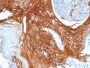 Cytokeratin 6A (KRT6A) (Basal Cell Marker) (KRT6A/2368), CF594 conjugate, 0.1mg/mL