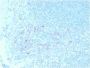 CD25/ IL2RA (Activated Lymphocyte Marker) (IL2RA/2395), CF594 conjugate, 0.1mg/mL