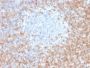 CD5 (Mantle Cell Lymphoma Marker) (CD5/2416), CF594 conjugate, 0.1mg/mL