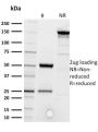 CD5 (Mantle Cell Lymphoma Marker) (CD5/2416), CF594 conjugate, 0.1mg/mL
