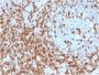 CD5 (Mantle Cell Lymphoma Marker)(CD5/2419), CF594 conjugate, 0.1mg/mL