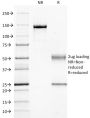 Guanine nucleotide-binding protein alpha-q / GNAQ / G-ALPHA-q(GNAQ/2434), CF594 conjugate, 0.1mg/mL