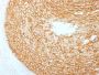 HER-2 / c-erbB-2 / neu / CD340 (ERBB2/2453), CF594 conjugate, 0.1mg/mL