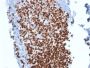 Ki-67 (Proliferating Cell Marker) (MKI67/2462), CF594 conjugate, 0.1mg/mL