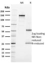Ki-67 (Proliferating Cell Marker) (MKI67/2462), CF594 conjugate, 0.1mg/mL