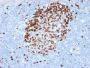 Ki-67 (Proliferating Cell Marker) (MKI67/2462), CF594 conjugate, 0.1mg/mL