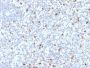 Perforin-1 (Pore Forming Protein) (Apoptosis Marker) (PRF1/2468), CF594 conjugate, 0.1mg/mL