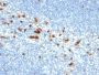 CD103 / Integrin alpha E (T-Cell Lymphoma & Hairy Cell Leukemia Marker) (ITGAE/2474), CF594 conjugate, 0.1mg/mL