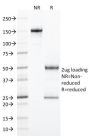 CD103 / Integrin alpha E (T-Cell Lymphoma & Hairy Cell Leukemia Marker) (ITGAE/2474), CF594 conjugate, 0.1mg/mL