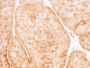 GLUT-1 (Tumor Progression and Mesothelioma Marker) (GLUT1/2475), CF594 conjugate, 0.1mg/mL