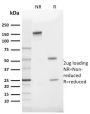GLUT-1 (Tumor Progression and Mesothelioma Marker) (GLUT1/2475), CF594 conjugate, 0.1mg/mL