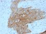 GLUT-1 (Tumor Progression and Mesothelioma Marker) (GLUT1/2475), CF594 conjugate, 0.1mg/mL