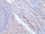 GLUT-1 (Tumor Progression and Mesothelioma Marker) (GLUT1/2476), CF594 conjugate, 0.1mg/mL