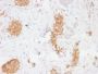 GLUT-1 (Tumor Progression and Mesothelioma Marker) (GLUT1/2476), CF594 conjugate, 0.1mg/mL