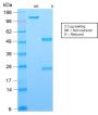 Bcl-6 (Follicular Lymphoma Marker) (rBCL6/1718), CF594 conjugate, 0.1mg/mL