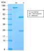 NGF-Receptor (p75) / CD271 (Soft Tissue Tumor Marker) (NGFR/2550R), CF594 conjugate, 0.1mg/mL