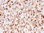 NGF-Receptor (p75) / CD271 (Soft Tissue Tumor Marker)(rNGFR/1965), CF594 conjugate, 0.1mg/mL