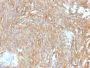 DOG-1 / TMEM16A (Gastrointestinal Stromal Tumor Marker) (DG1/2564R), CF594 conjugate, 0.1mg/mL