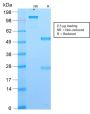 DOG-1 / TMEM16A (Gastrointestinal Stromal Tumor Marker) (DG1/2564R), CF594 conjugate, 0.1mg/mL