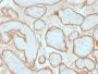 EGFRvIII (Epidermal Growth Factor Receptor, Variant III) (GFR/2600R), CF594 conjugate, 0.1mg/mL