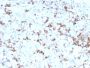 Prolactin (Pituitary Tumor Marker)(PRL/2641), CF594 conjugate, 0.1mg/mL