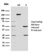 ERCC1 / RAD10 (Tumor Progression Marker)(ERCC1/2683), CF594 conjugate, 0.1mg/mL