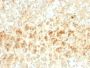 Adipophilin / Perilipin-2 (Marker of Lipid Accumulation) (ADFP/2755R), CF594 conjugate, 0.1mg/mL