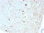 Calretinin / Calbindin 2 (Mesothelioma Marker)(CALB2/2786), CF594 conjugate, 0.1mg/mL