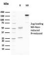 Desmoglein-3 (Squamous Cell Marker)(DSG3/2796), CF594 conjugate, 0.1mg/mL