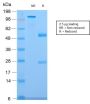 CELA3B / ELA3B (Pancreatic Function Marker) (CELA3B/2809R), CF594 conjugate, 0.1mg/mL