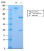 CELA3B / ELA3B (Pancreatic Function Marker) (CELA3B/2810R), CF594 conjugate, 0.1mg/mL