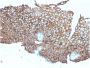 Desmoglein-3 (Squamous Cell Marker)(DSG3/2840), CF594 conjugate, 0.1mg/mL