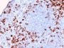Human Kappa Light Chain / IGKC (B-Cell Marker)(KLC2886R), CF594 conjugate, 0.1mg/mL