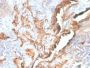 Tenascin C (Stromal Marker For Epithelial Malignancy) (TNC/2981R), CF594 conjugate, 0.1mg/mL