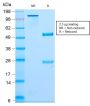 Neurofilament (NF-L) (Neuronal Marker) (NEFL/2983R), CF594 conjugate, 0.1mg/mL