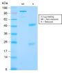 Renal Cell Carcinoma (Carbonic Anhydrase IX) (CA9/2993R), CF594 conjugate, 0.1mg/mL