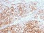 MCAM (Melanoma Cell Adhesion Molecule) / MUC18 / CD146(MCAM/3046), CF594 conjugate, 0.1mg/mL