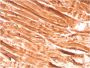 Dystrophin (DMD) (Marker of Duchenne and Becker Muscular Dystrophy)(DMD/3242), CF594 conjugate, 0.1mg/mL