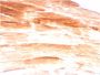 Dystrophin (DMD) (Marker of Duchenne and Becker Muscular Dystrophy)(DMD/3245), CF594 conjugate, 0.1mg/mL