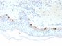 Tyrosinase-Related Protein-1 (TYRP-1) (Melanoma Marker)(TYRP1/3281), CF594 conjugate, 0.1mg/mL
