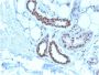 Nucleophosmin (Acute Myeloid Leukemia Marker)(NPM1/3285), CF594 conjugate, 0.1mg/mL