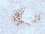 TRAF1 (TNFR-Associated Factor 1) (Lymphomatoid Papulosis Marker)(TRAF1/3298), CF594 conjugate, 0.1mg/mL