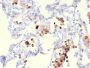 Napsin A (Lung Adenocarcinoma Marker)(NAPSA/3306), CF594 conjugate, 0.1mg/mL
