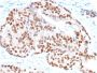 NKX3.1 (Metastatic Prostate Adenocarcinoma Marker)(NKX3.1/3347), CF594 conjugate, 0.1mg/mL