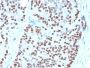 NKX3.1 (Metastatic Prostate Adenocarcinoma Marker)(NKX3.1/3348), CF594 conjugate, 0.1mg/mL