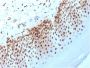 Nucleophosmin (Acute Myeloid Leukemia Marker)(NPM1/3398), CF594 conjugate, 0.1mg/mL