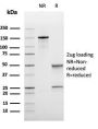 Bcl-6 (Follicular Lymphoma Marker)(rBCL6/1475), CF594 conjugate, 0.1mg/mL
